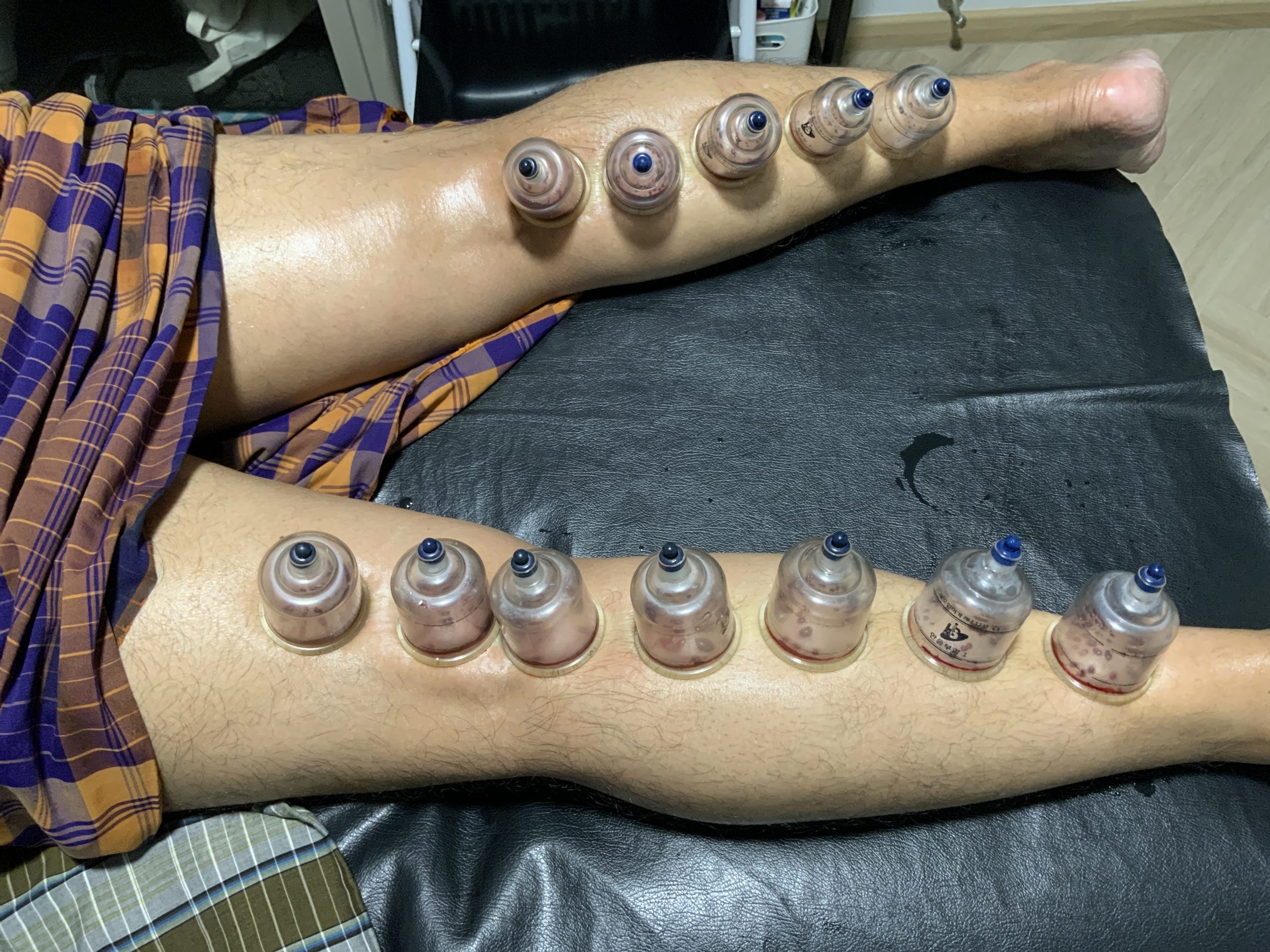 Specialized Treatments