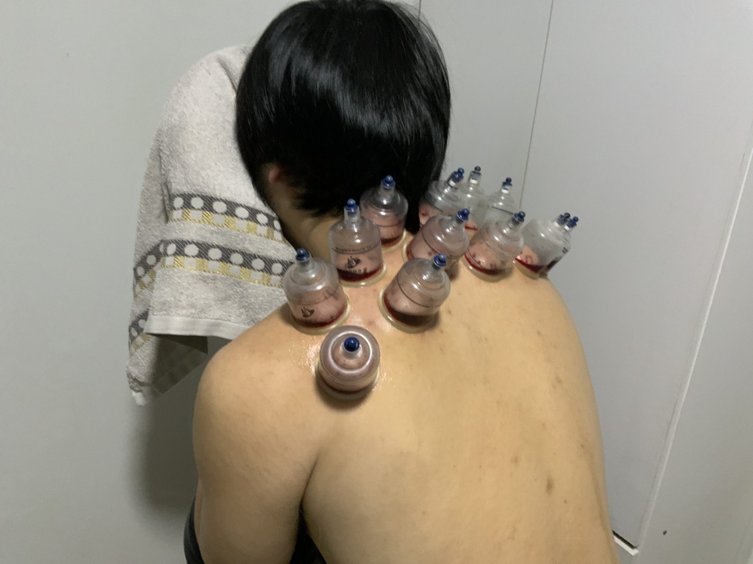 Specialized Treatments